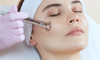 Diamond Microdermabrasion Facial Session